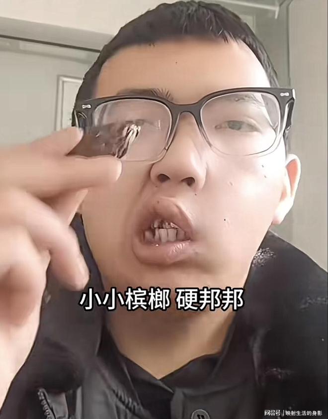 导致脸部变形还边嚼边劝大家别碰槟榔尊龙凯时app平台男子嚼槟榔七年(图3)